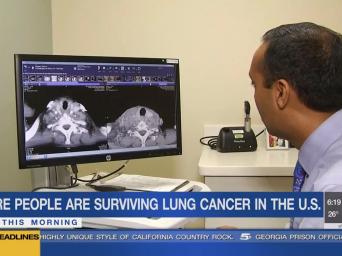 KCTV 5 News. More people are surviving lung cancer in the U.S. New this morning.