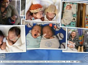 CBS This Morning Saturday. Photos of multiple sets of twins at the Saint Luke's Hospital NICU