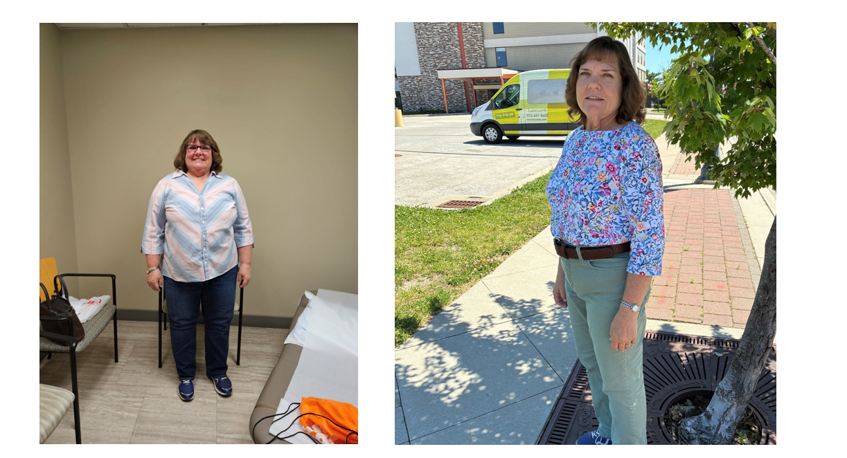 Cheryl before and after surgery. 