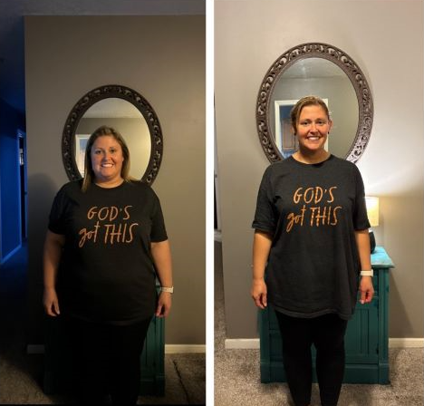 Leighanna before and after surgery.